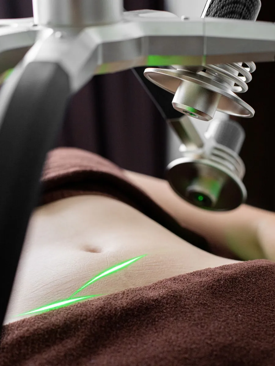 Detalle de aparatología estética de última generación utilizada en tratamientos corporales